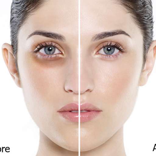 Trị liệu dành cho mắt